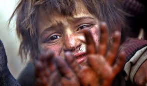 نتیجه تصویری برای کودکان بهبود یافته اعتیاد