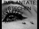 IMPLANTATE stechen - TUT DAS WEH? -