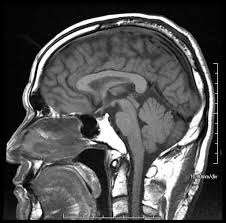 「MRI」の画像検索結果