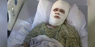 savannah acid attack Picture