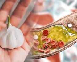 Garlic cholesterol