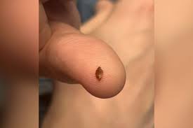 Horreur à Paris! Spectateurs Dévores par Punaises de Lit en Plein Cinéma!