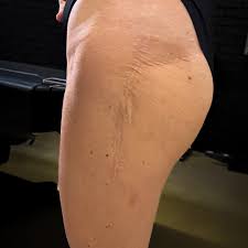 This new #watercolor #scarcoveruptattoo is blowing us all ...