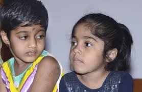 The Hindu CAUSE FOR CONCERN: Kamalavalli, 4, (left) and Sree Valli, 8, were diagnosed with neonatal diabetes a few months after birth. Photo: S.S.Kumar - 14THKAMALAVALLI_835831f