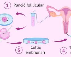 Imagem De Fiv Convencional Process