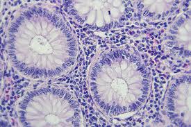 Agenus scraps ph. 3 colorectal study to narrow focus to colon