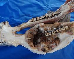 Imagem de Osteossarcoma