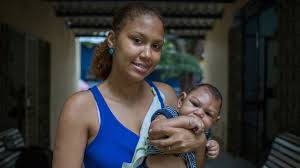 Image result for pictures of zika babies