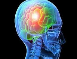 Genetics Now Link Epilepsy and Migraines