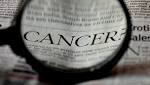  People eating high-cholesterol diet face increased risk of colon cancer: Study