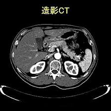「CT」の画像検索結果