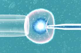 Image result for (IVF)