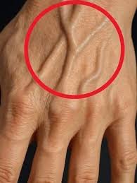 If you have visible veins, it means you are… See more