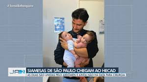 Gêmeas siameses chegam ao Hecad para cirurgia de separação
