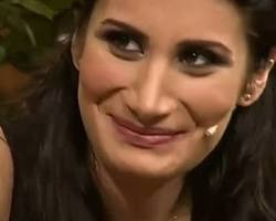 İrem Derici estetiksiz ve estetikli hali resmi