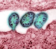 Death from Ebola-like virus reported in Iowa after travel to West Africa