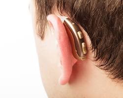 Image of BehindtheEar (BTE) Hearing Aid