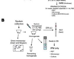 Image of bubonic plague diagnostic methods