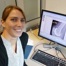 Dr. Ines Kutzner has received funding from the Research Council of Norway to investigate mechanisms behind loosening of knee prostheses - ines_3