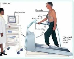 Image of Treadmill test machine