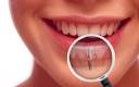 Prix des implants dentaires - ISI Clinique