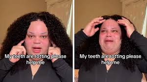 Jools Lebron Asks For Donations To Fix Rotting Teeth