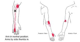 Image result for ‫تنیس البو‬‎