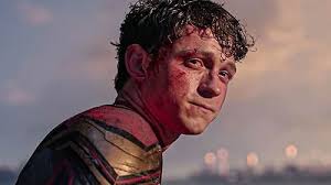 Tom Holland Injury Raises MCU Safety Questions: Every Time Marvel Actors Got Injured While Filming