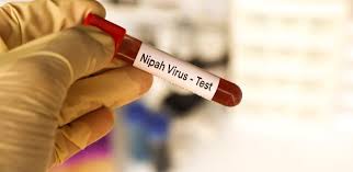 'Nipah é altamente letal, mas se espalha menos que coronavírus', diz médica