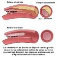 Dans le cholestrol, du bon et du mauvais : Analyse de sang : bien