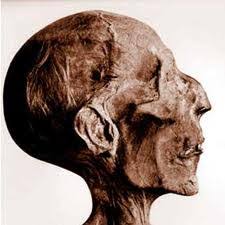 Résultat de recherche d'images pour "elongated skulls"