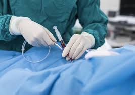 Resultado de imagen de imagenes de infarto agudo de miocardio tratamiento cirugia