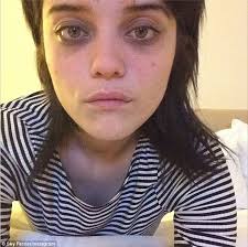 The show must go on! Sky Ferreira endures agonizing injury and no sleep as she prepares to rock Sydney stage - article-2583085-1C607A9400000578-705_634x630