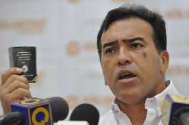 José Vicente Rivero a través de un contacto telefónico con Unión Radio, informó que su hermano Antonio Rivero cumple este jueves 12 días de huelga de hambre ... - antonio-rivero-903x600