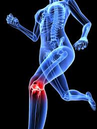 Image result for joint pain in knee