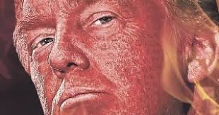 Image result for clown nose nydailynews