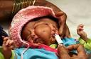 Indian baby born with two faces 'doing well' one month after birth ... - babyMOS1503_468x306