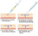 Somatuline Depot (lanreotide) Injection: Long-Term Treatment for