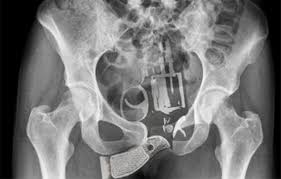 Image result for Vagina