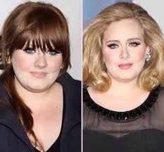 Resultado de imagem para before after surgery