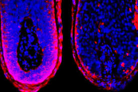 Preventing Hair Loss Through Inhibition of an Age-Old Biological Process - 1