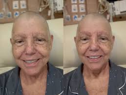 Roseana Sarney: em tratamento contra câncer, deputada é internada com pneumonia