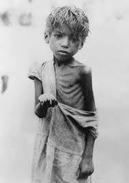 Image result for starving people