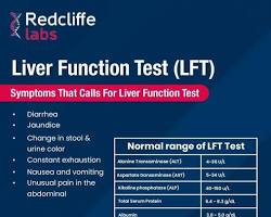 Image of Liver Function Tests (LFTs)