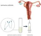 Anti-aboiement ultrasons : dispositif anti aboiement pas cher