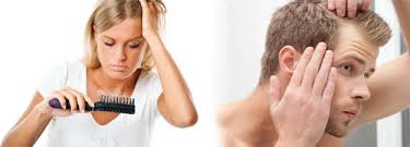 SAÇ DÖKÜLMESİ ile ilgili görsel sonucu