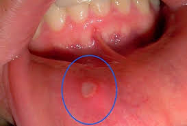 images?q=tbn:ANd9GcTN2ekjisZlJQkGYN6Zqz mgsiTPn2r2ISXr7vJR4HLsa7qM3CD