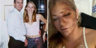 Virginia Giuffre, Prince Andrew Accuser, Shares Devastating Health Update After Car Crash