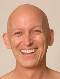 David Wagner (after cancer) - david-wagner-bald