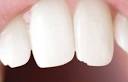 Rver de perdre ses dents Signification des dents en rve